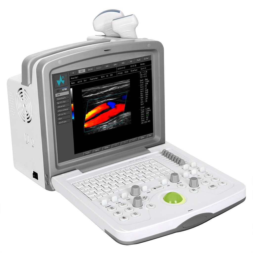 FDC6000 Full Digital Color Doppler Diagnostic System