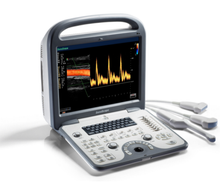 Load image into Gallery viewer, Sonoscape S6 multi-functional hand carried Color Doppler ultrasound system