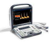 Sonoscape S6 multi-functional hand carried Color Doppler ultrasound system