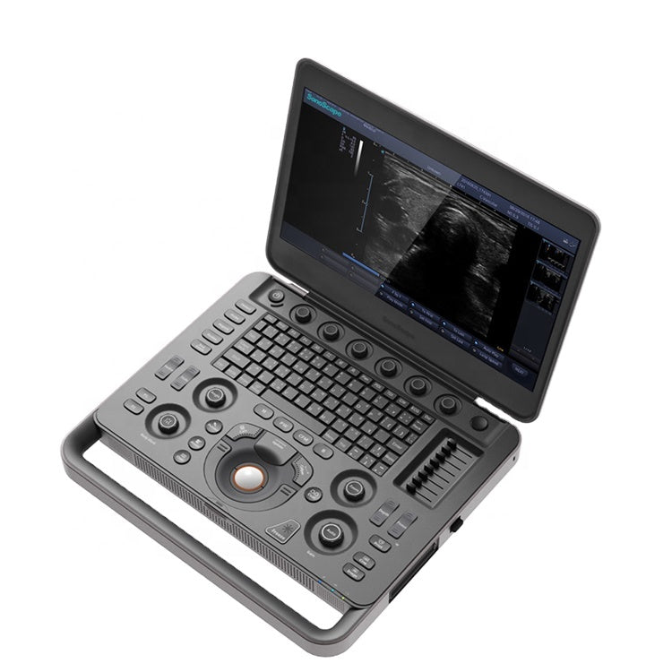 SONOSCAPE X5 Portable Color Doppler System OB / GYN Ultrasound