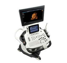 Load image into Gallery viewer, S40 Trolley Color Doppler Ultrasound
