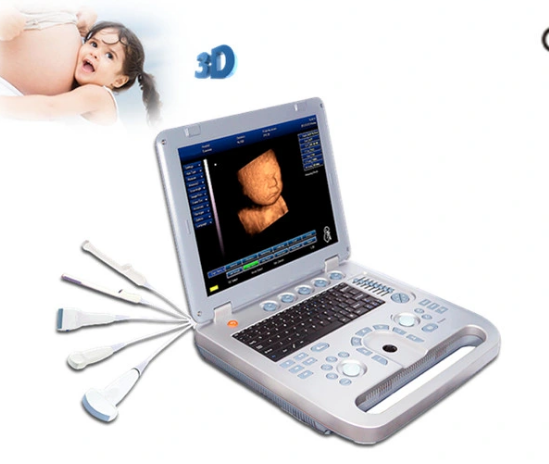 Sunbright Uem-800d 3D Portable Ultrasound Machine Price Ultrasound Medical