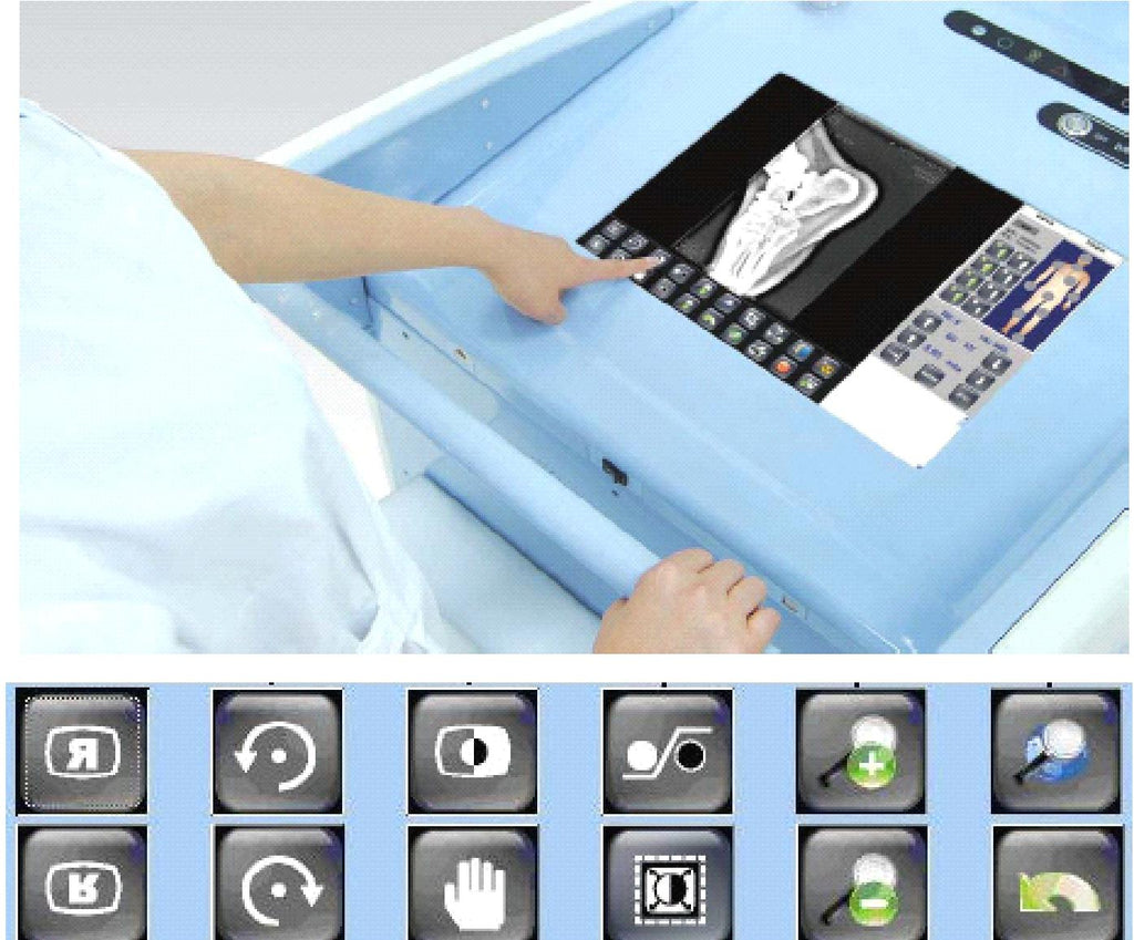 DR200 High Frequency Mobile Digital Radiography System