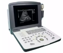 in-A660 Ultrasonic Machines Handheld Laptop Portable Ultrasound Scanner Machine
