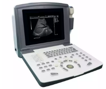 Load image into Gallery viewer, in-A660 Ultrasonic Machines Handheld Laptop Portable Ultrasound Scanner Machine