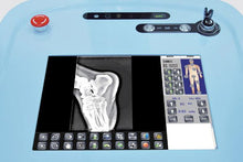 Cargar imagen en el visor de la galería, DR200 High Frequency Mobile Digital Radiography System