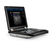 Cargar imagen en el visor de la galería, 2D/3D/4D Laptop Colour Portable Diagnostic Color Doppler Ultrasound Scanners