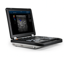 Load image into Gallery viewer, 2D/3D/4D Laptop Colour Portable Diagnostic Color Doppler Ultrasound Scanners