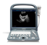 Portable Color Ultrasound Scanner Machine Sonoscape S2