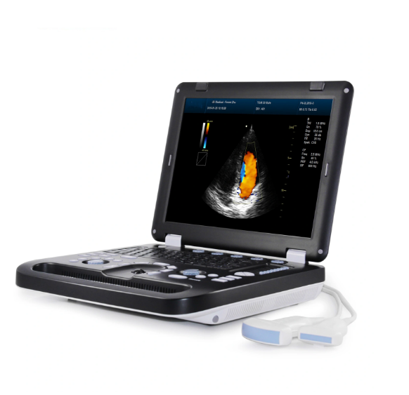 2D/3D/4D Laptop Colour Portable Diagnostic Color Doppler Ultrasound Scanners