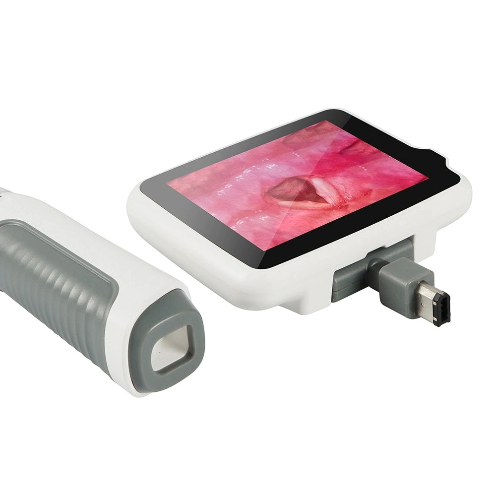 Anesthesiology Portable Laryngoscope Set Price Tracheal Intubation USB Video Laryngoscope Ent Examination Treatment Unit Ent Unit Blow