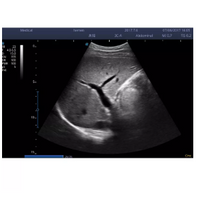 Load image into Gallery viewer, SonoScape S22 Color Ultrasound Doppler System