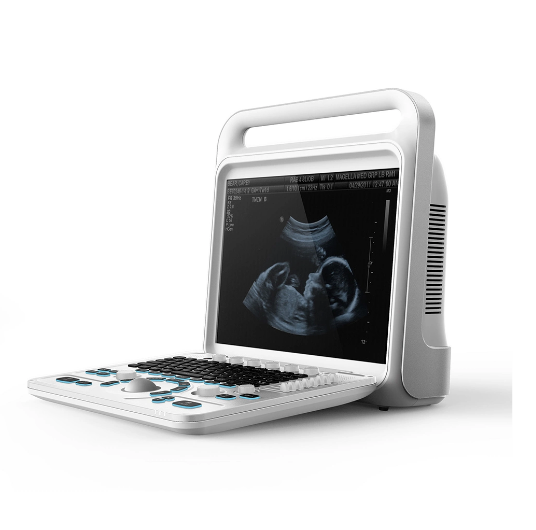 Ultrasound Machine 15 Inch LCD Flat Screen 4D Full Digital Color Doppler Medical Portable Ultrasound Scanner Equipment