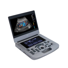 Load image into Gallery viewer, Cheap Price Portable Ultrasound Machines Sonoscape Color Doppler Ultrasound Scannser