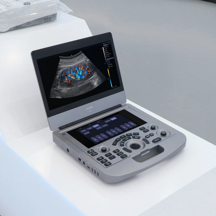 Cheap Price Portable Ultrasound Machines Sonoscape Color Doppler Ultrasound Scannser
