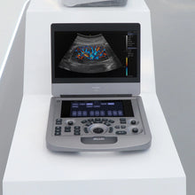 Cargar imagen en el visor de la galería, Cheap Price Portable Ultrasound Machines Sonoscape Color Doppler Ultrasound Scannser