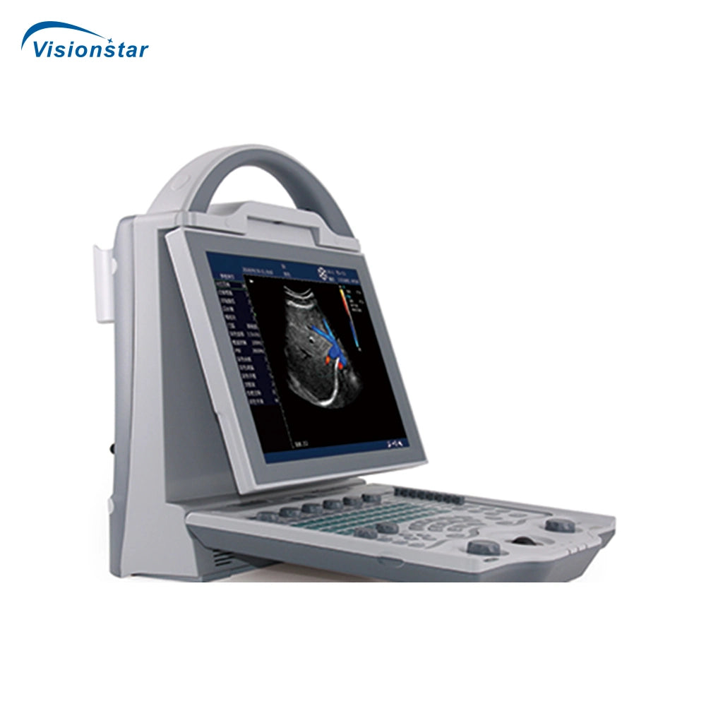 Dcu-12 Color Doppler Ultrasound Scanner (Veterinary)