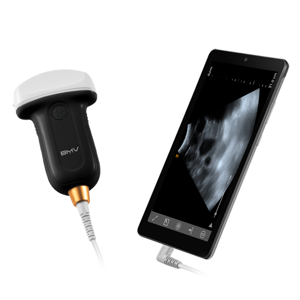 MX5 portable B/W ultrasound system