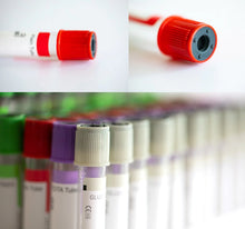 Cargar imagen en el visor de la galería, Disposable High Quality Vacuum Blood Sample Collection Tube
