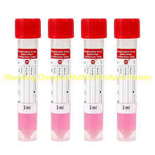 Cargar imagen en el visor de la galería, Disposable Viral Transport Tube Nasopharyngeal Swab and Throat Swab Vtm Tube Viral Transport Tube