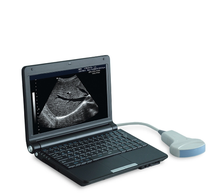 Load image into Gallery viewer, UEM-A007 Human Medical Instrument Portable Laptop Ultrasound Scanner