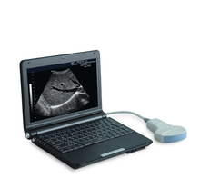 Cargar imagen en el visor de la galería, UEM-A007 Human Medical Instrument Portable Laptop Ultrasound Scanner