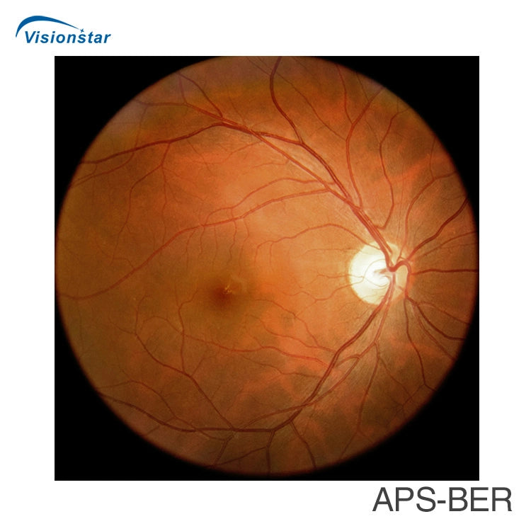 FDA Approved Aps-Ber Eye Digital Fundus Camera Price