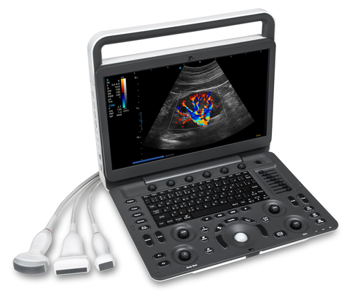 Sonoscape E1V Animal Bw Ultrasound System Medical Portable Veterinary Ultrasound Machine