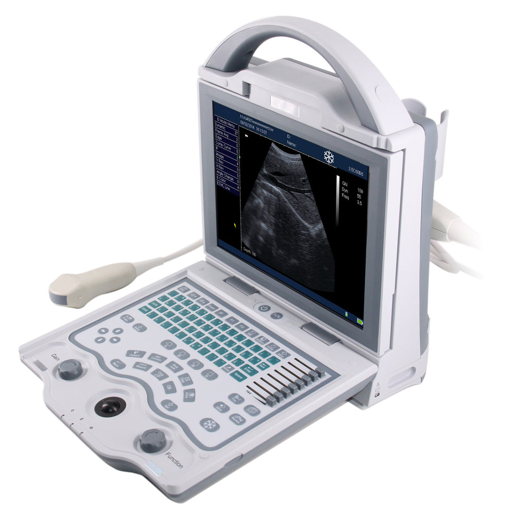 Sonographe, Sonography, Sonar, Digital Portable Ultrasound with Lightweight, Battery LED Display, (UEM540) Ultrasound Scan Machine