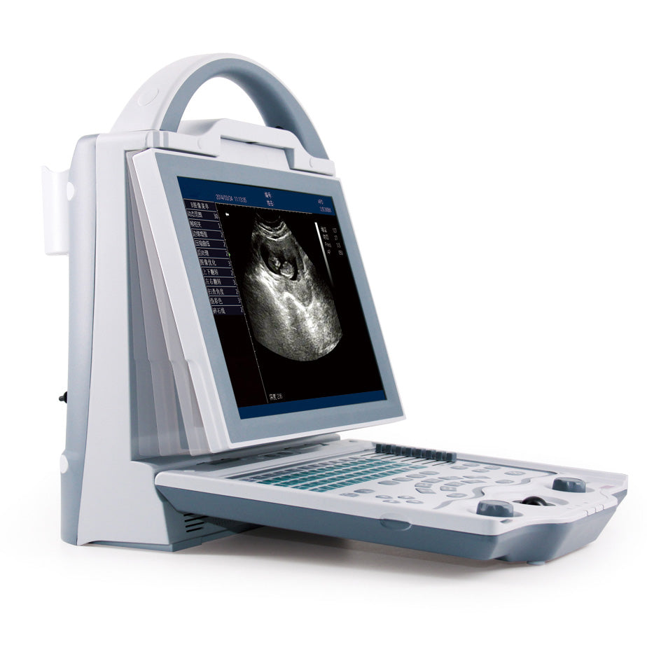 Sonographe, Sonography, Sonar, Digital Portable Ultrasound with Lightweight, Battery LED Display, (UEM540) Ultrasound Scan Machine