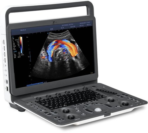 Sonoscape E1V Animal Bw Ultrasound System Medical Portable Veterinary Ultrasound Machine