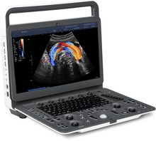 Load image into Gallery viewer, Sonoscape E1V Animal Bw Ultrasound System Medical Portable Veterinary Ultrasound Machine