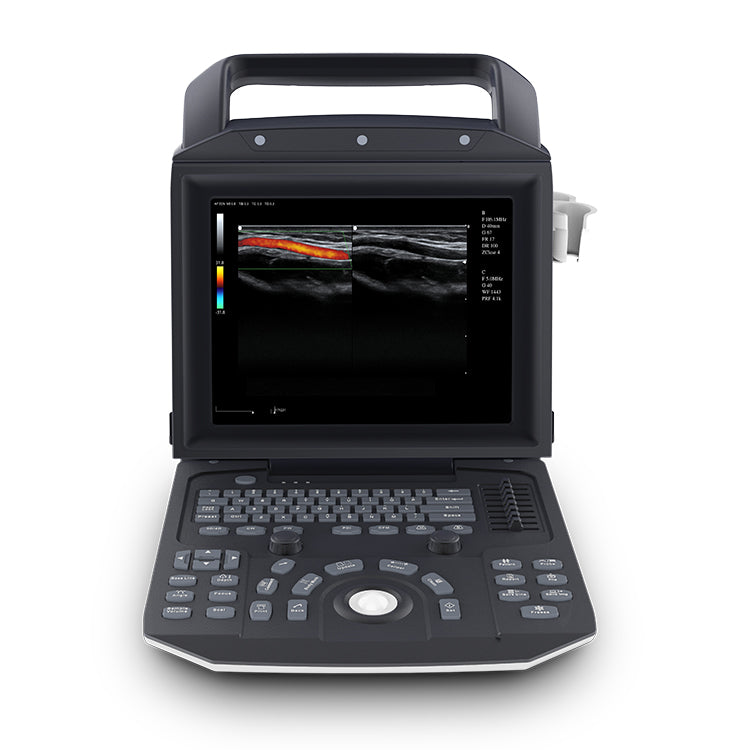 Portable Laptop type Full Digital Color Doppler Ultrasound System