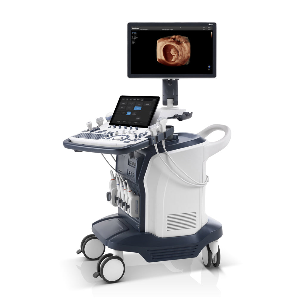 S60 Color Doppler Diagnostic Ultrasound System