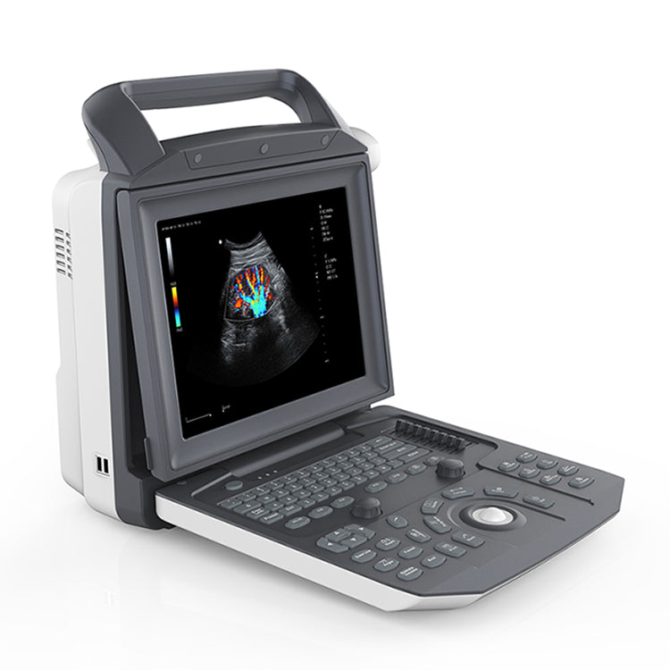 Portable Laptop type Full Digital Color Doppler Ultrasound System