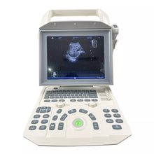 Cargar imagen en el visor de la galería, Portable 12.1 inch screen B/W Ultrasound Scanner with PW function Ultrasonic Scanner Ultrasound machine