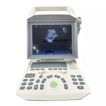Load image into Gallery viewer, Portable 12.1 inch screen B/W Ultrasound Scanner with PW function Ultrasonic Scanner Ultrasound machine