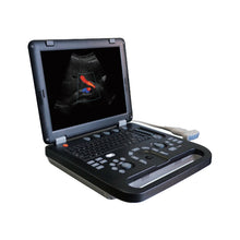 Load image into Gallery viewer, UEM-A024e Medical Equipment Ultrasonic System Laptop Ultrasound Scanner