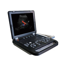 Cargar imagen en el visor de la galería, UEM-A024e Medical Equipment Ultrasonic System Laptop Ultrasound Scanner
