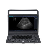 Sonoscape E1V Animal Bw Ultrasound System Medical Portable Veterinary Ultrasound Machine