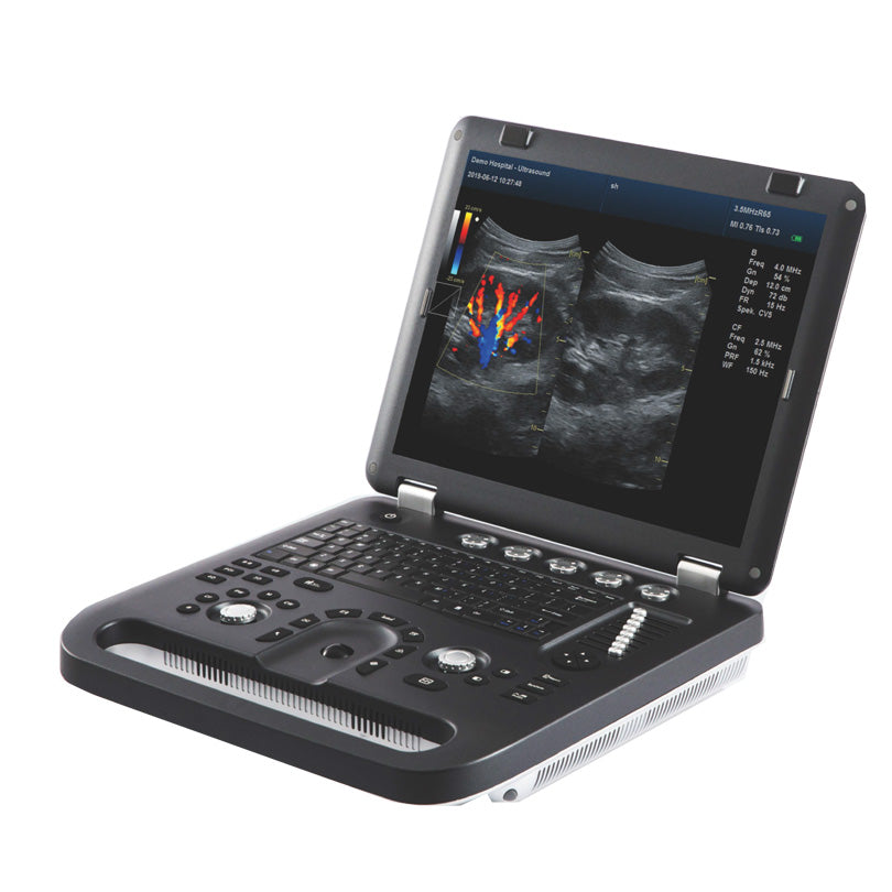UEM-A024e Medical Equipment Ultrasonic System Laptop Ultrasound Scanner
