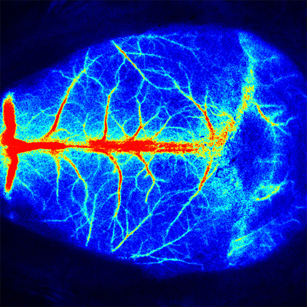 RFLSI Ⅲ Laser Speckle Imaging System