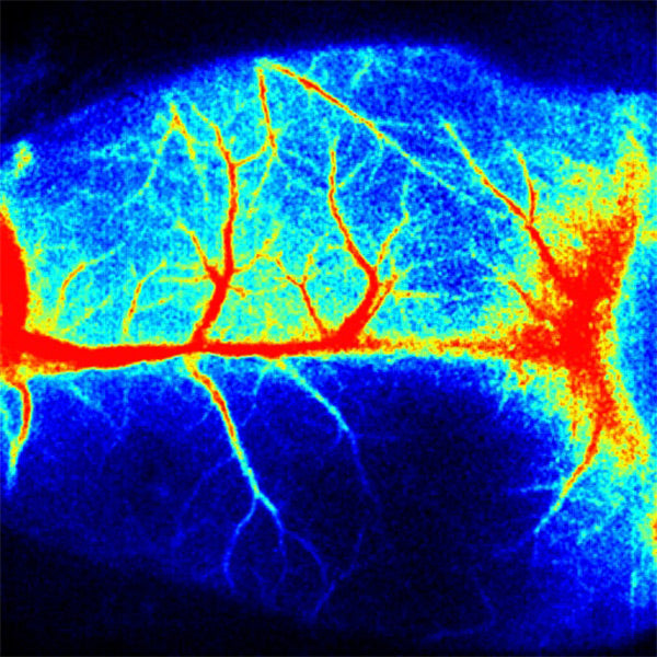 RFLSI Ⅲ Laser Speckle Imaging System