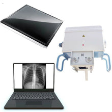 Cargar imagen en el visor de la galería, Medical Radiography System 5kw 25mA Mobile Portable X Ray Machine