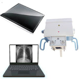 Medical Radiography System 5kw 25mA Mobile Portable X Ray Machine