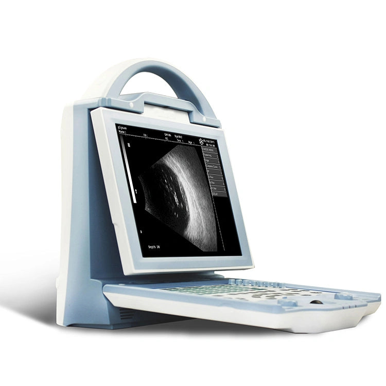 Ophthalmic Equipment Portable ODU-5 Ophthalmic Ultrasound Scanner