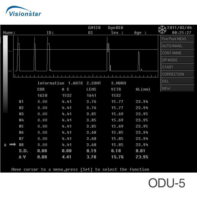 Ophthalmic Equipment Portable ODU-5 Ophthalmic Ultrasound Scanner