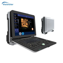 Load image into Gallery viewer, P6 Portable 4D Color Doppler Ultrasound