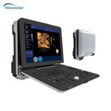 P6 Portable 4D Color Doppler Ultrasound