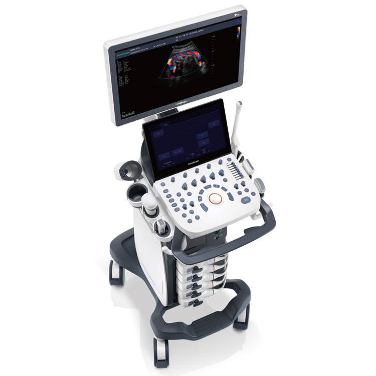 Sonoscape P15 4D/5D Cart Color ultrasound 21.5" High Resolution LED Color Monitor and 13.3inch touch screen